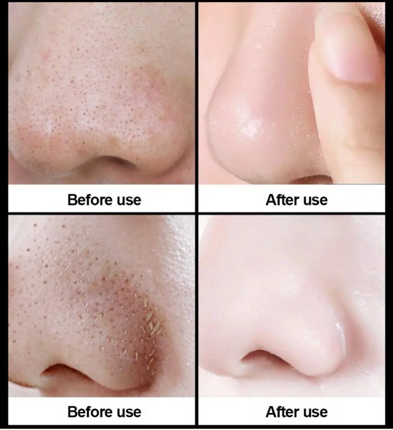 Masque facial Soin de la peau 