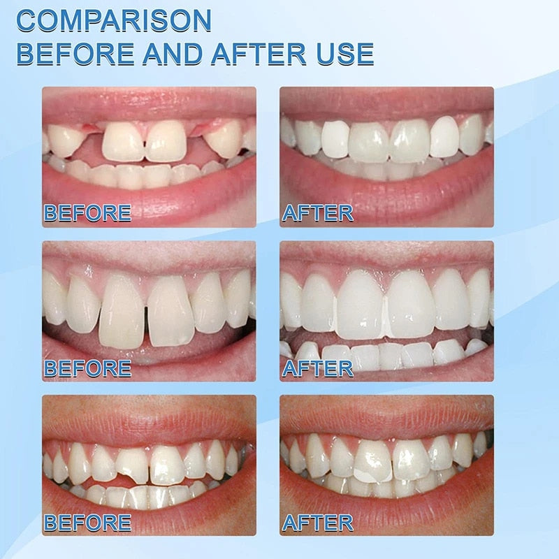 Granulés pour la réparation des dents